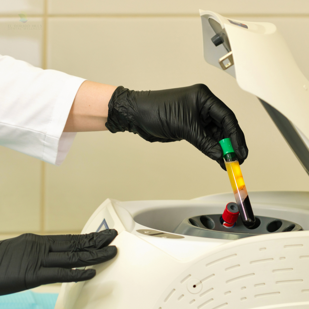 Our PRF Process