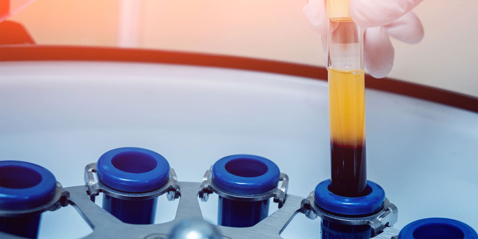 close up tube for Platelet Rich Fibrin treatment