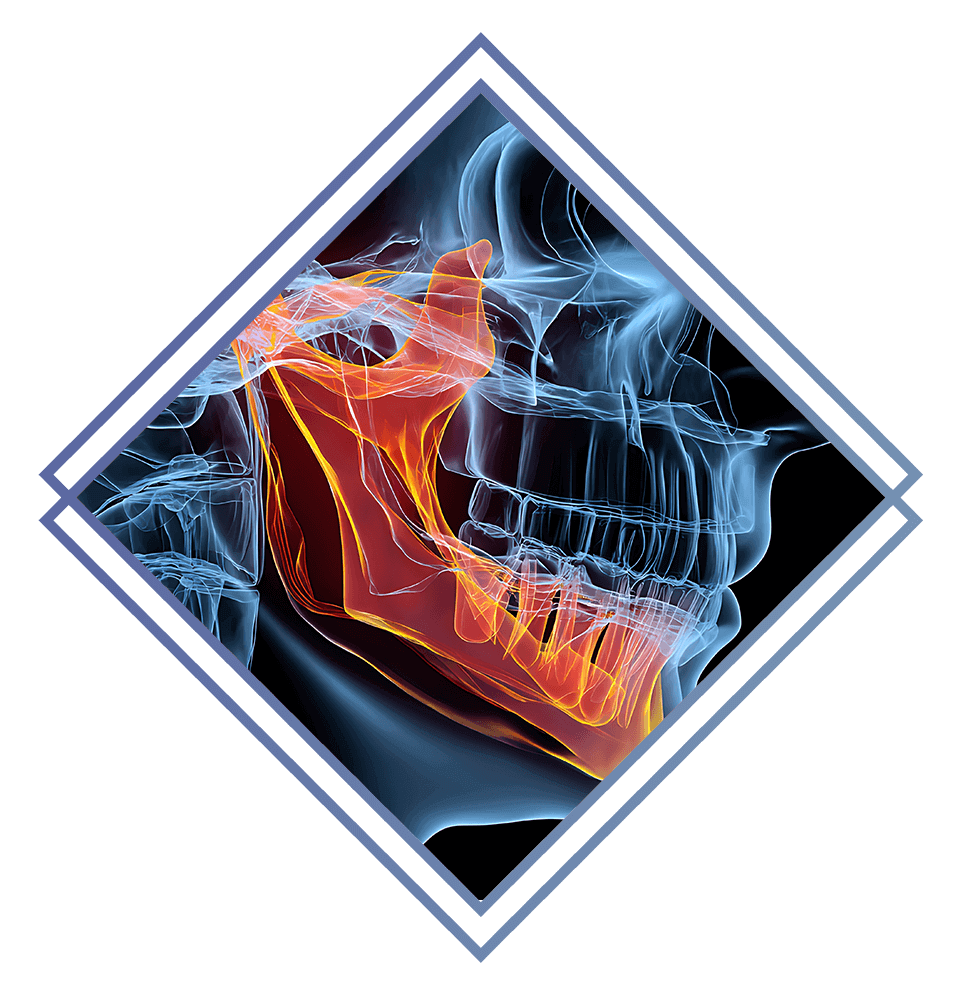 close up jaw illustration for TMJ